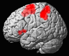 results from an fMRI study investigating motor imagery